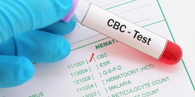 CBC TEST GUIDE: Purpose, Preparation, Benefits - IMMUNOSCIENCES