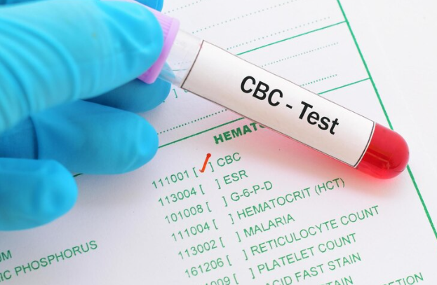 CBC TEST GUIDE: Purpose, Preparation, Benefits