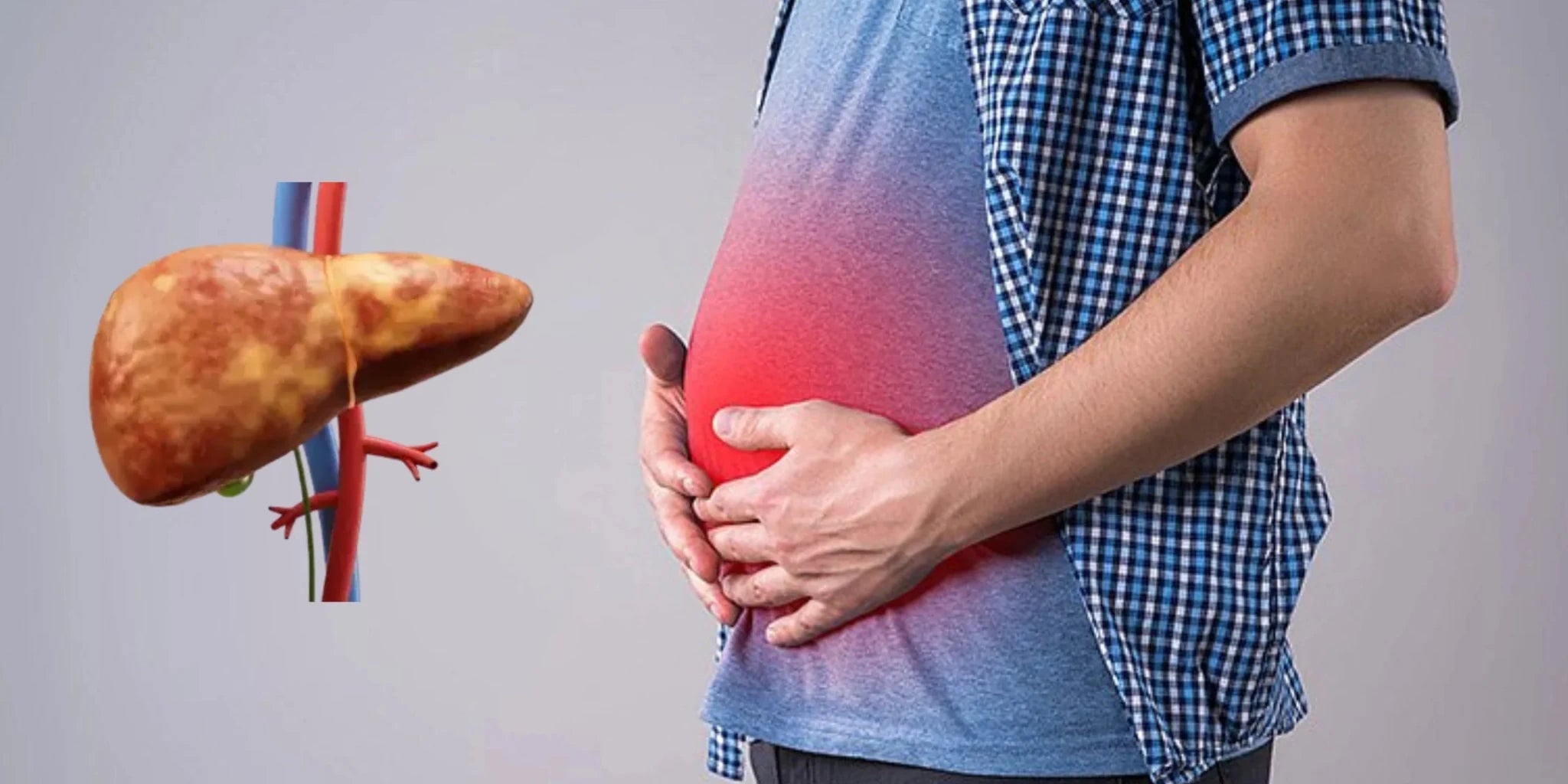 Does fatty liver Cause Bloating? Symptoms, Causes & Relief Tips - IMMUNOSCIENCES