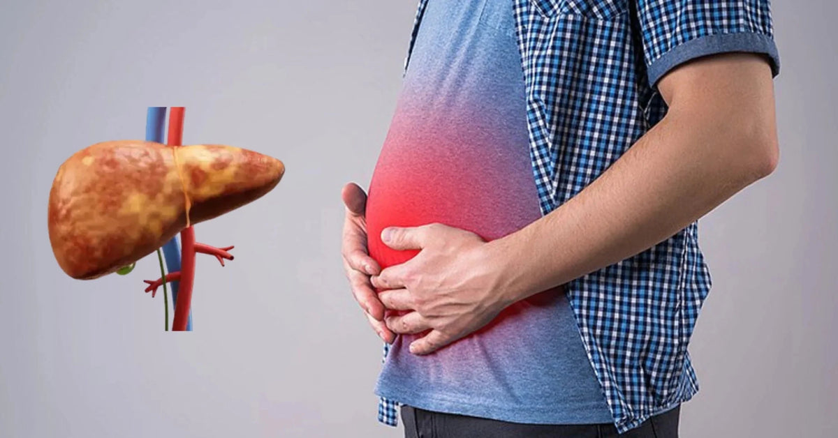 Does fatty liver Cause Bloating? Symptoms, Causes & Relief Tips - IMMUNOSCIENCES