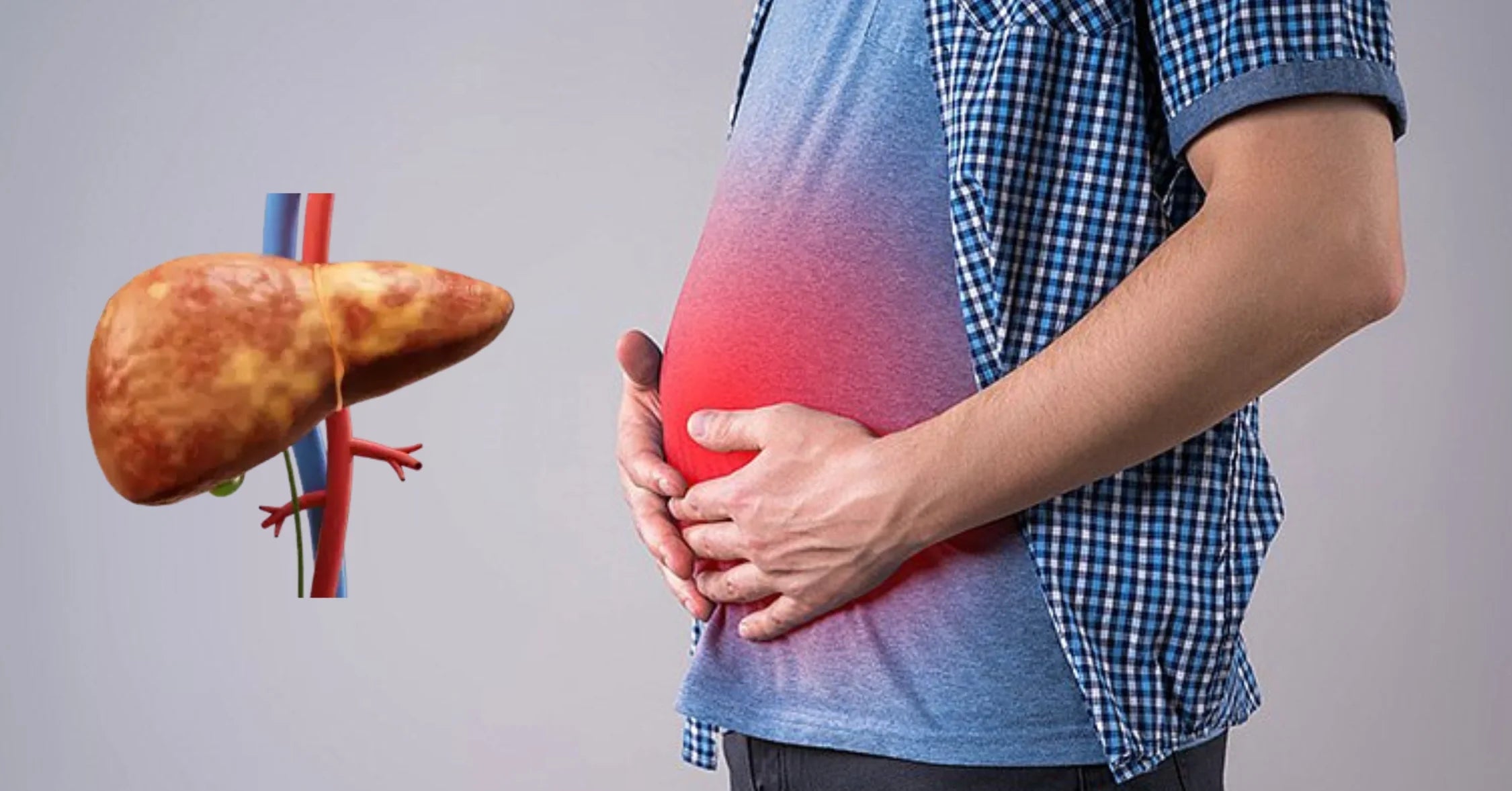 does fatty liver cause bloating