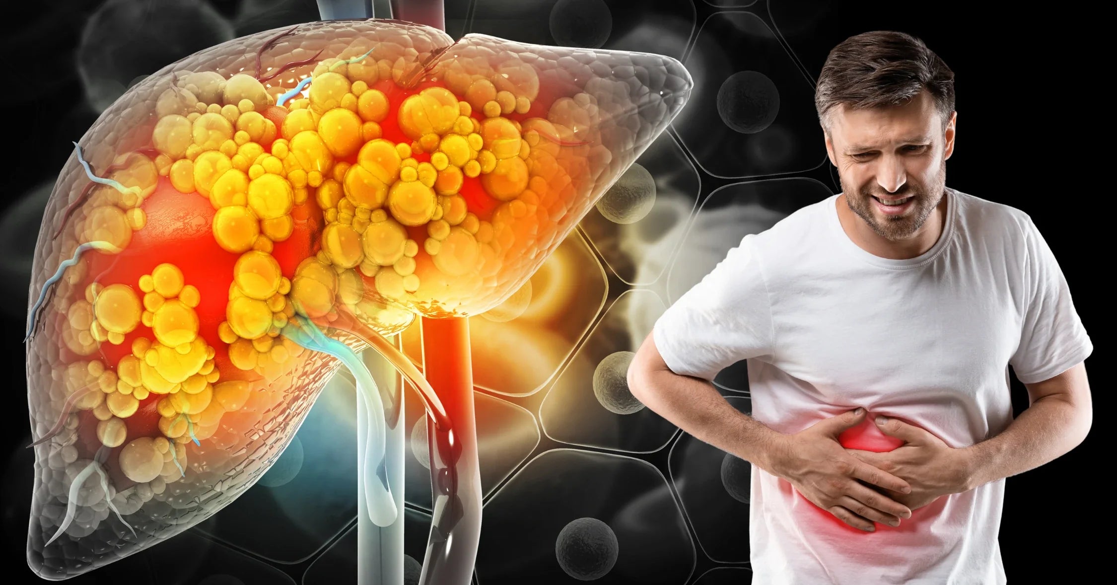 Fatty Liver Grade 2: Is it Dangerous? Causes, Symptoms, Treatment, and –  IMMUNOSCIENCES