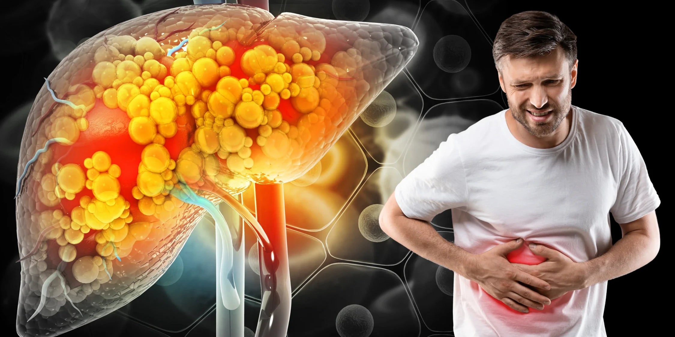 Fatty Liver Grade 2: Is it Dangerous? Causes, Symptoms, Treatment, and Prevention - IMMUNOSCIENCES