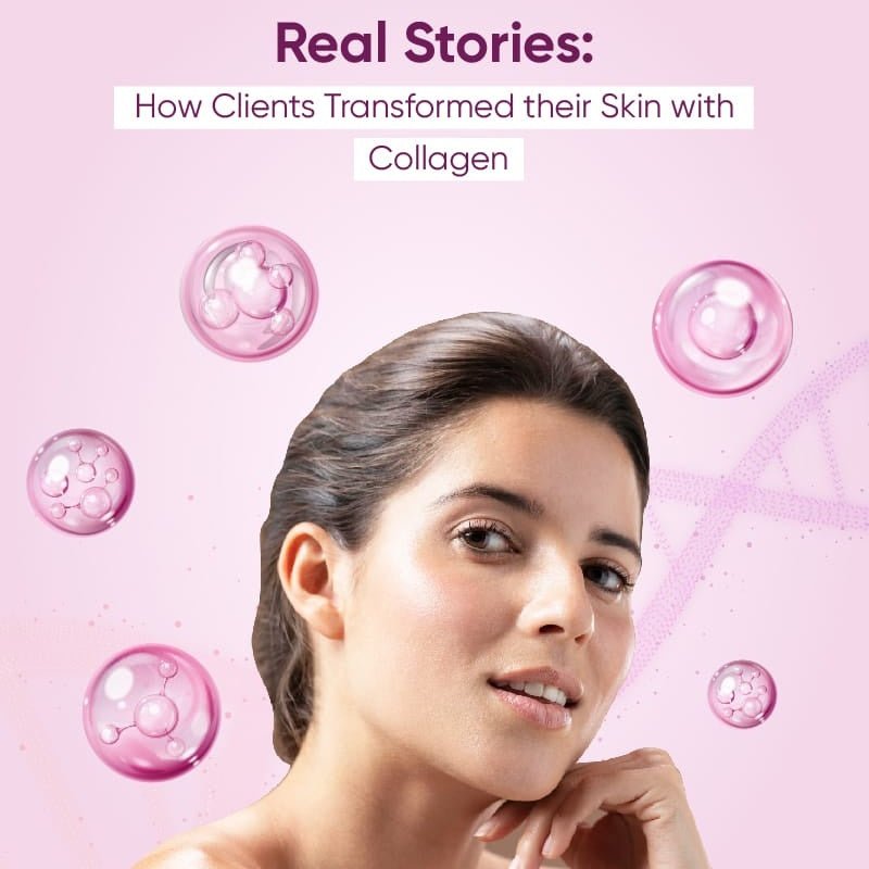 Real Stories: How Clients Transformed Their Skin with Collagen - IMMUNOSCIENCES