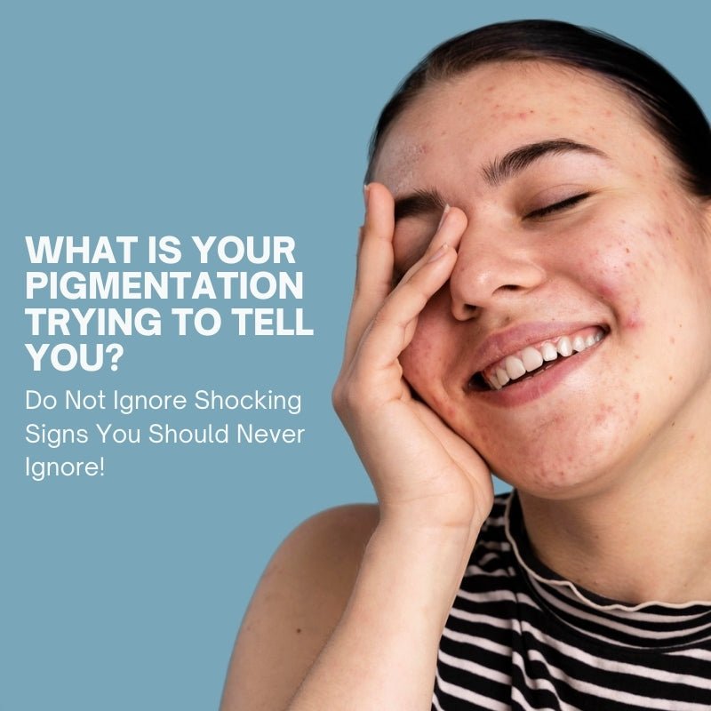 What Is Your Pigmentation Trying To Tell You? Do Not Ignore Shocking Signs You Should Never Ignore! - IMMUNOSCIENCES