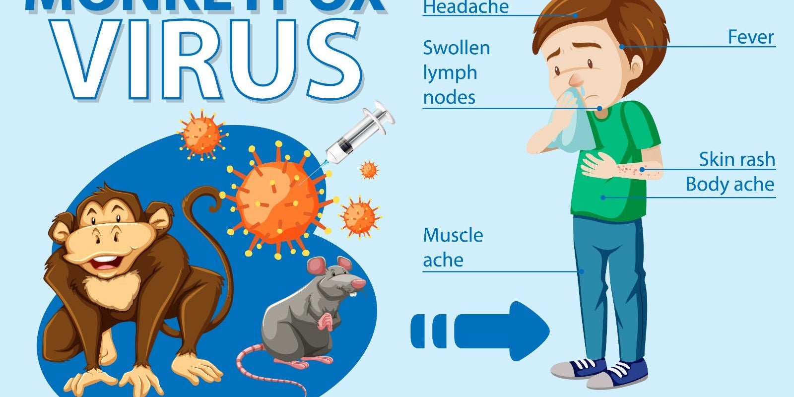 Monkeypox Outbreak: All You Need To know- Symptoms, Treatment &amp; Precautions - IMMUNOSCIENCES