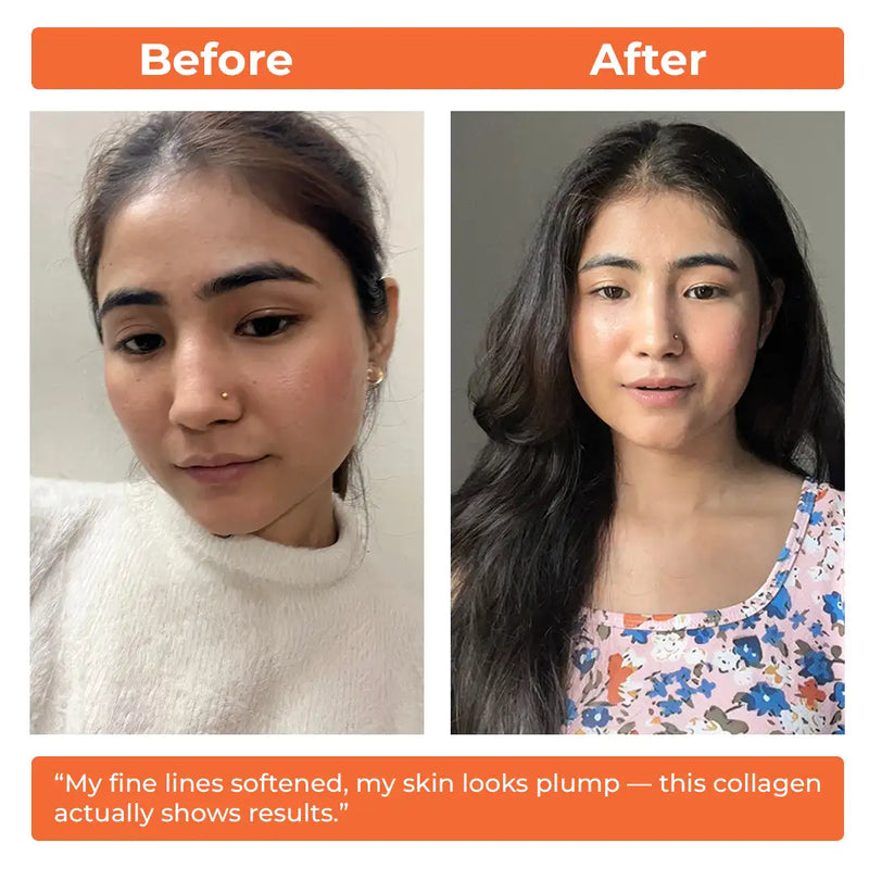 Korean Marine Collagen Powder for Glowing Skin, Hair & Nails | Hydrolyzed Collagen Peptides | Anti-Aging Supplement