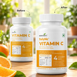 Vitamin C Supplement – Boost Immunity, Skin Health & Collagen Production